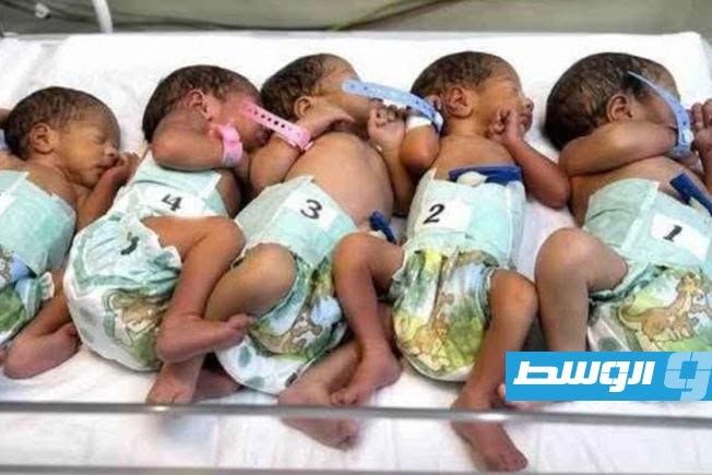 يمنية تضع 5 توائم في حالة ولادة نادرة